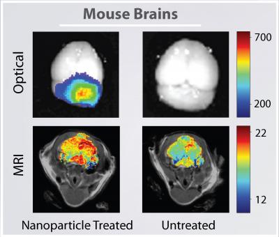 Brain Imaging
