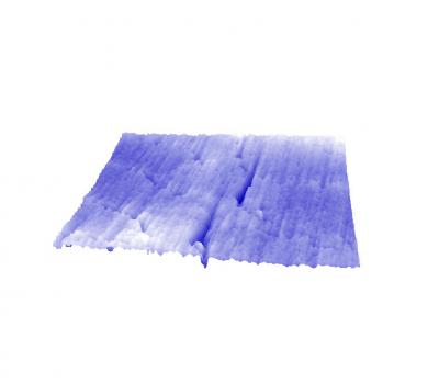 Tooth Surface