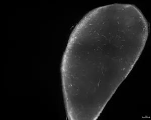Counting eggs in human ovarian tissue