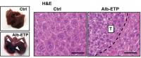 ETP Overexpression in Liver Tissues