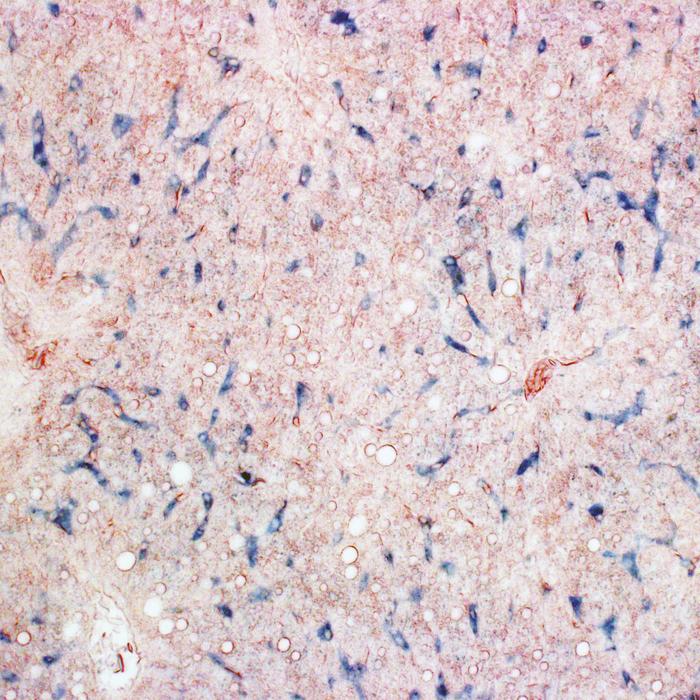 Iron in liver