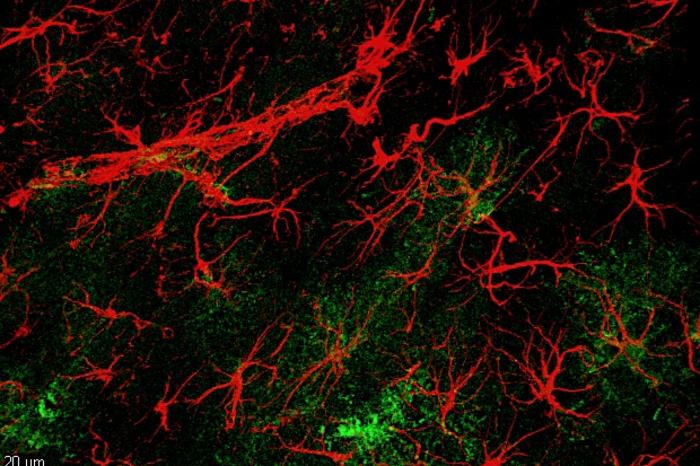 Molecule reverses cognitive deficits associated with aging and dementia in animal tests
