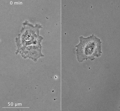 Nucleus Plays a Role in Movement