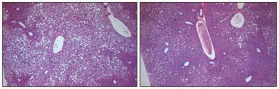 Liver Comparison
