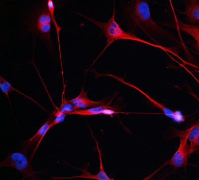 Glioblastoma Driver Genes 