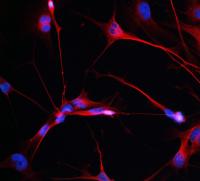 Glioblastoma Driver Genes 