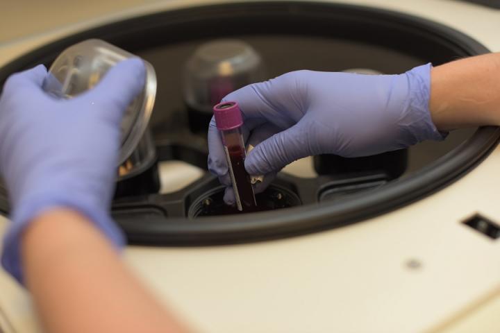 Blood Test