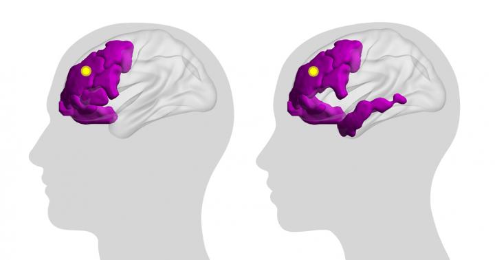 Using Computational Modeling To Study The Brain