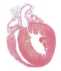 Histological Section Taken from an mdx Heart (2 of 2)