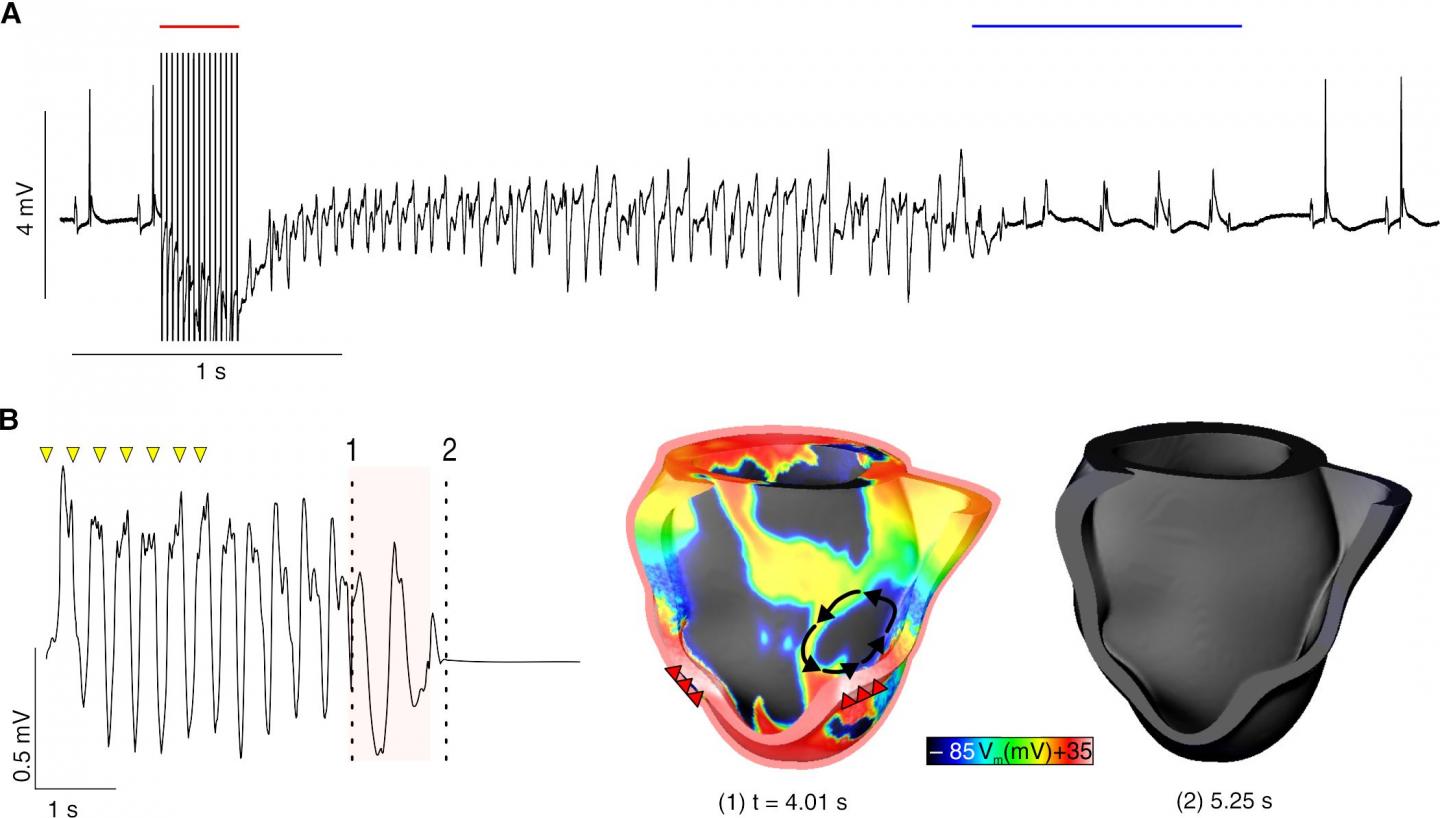Optogenetic Defibrillation
