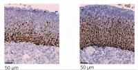 Adrenal glands