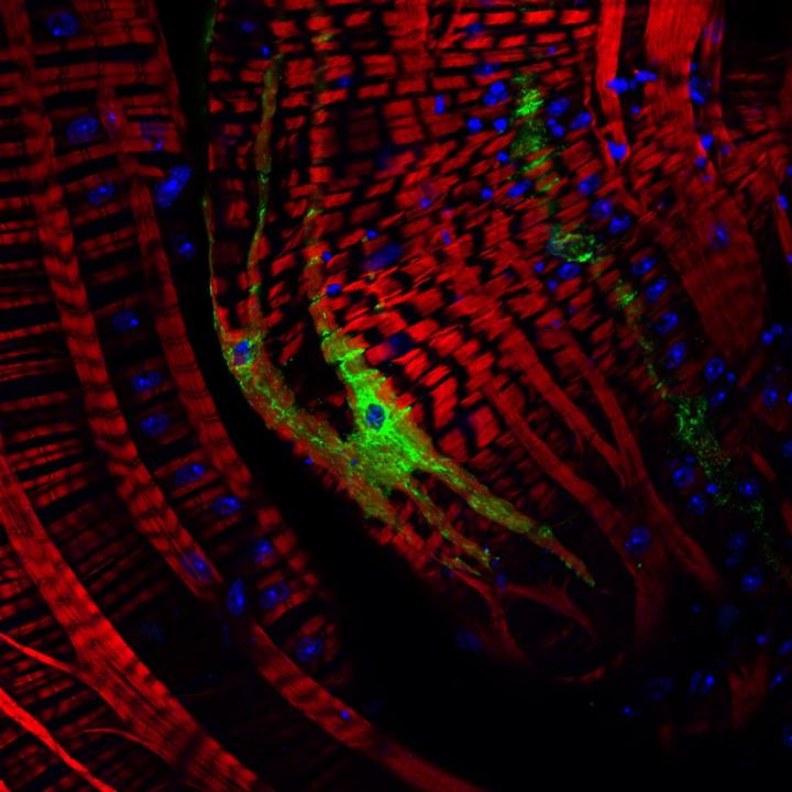 Fruit Fly Digestive Tract Cells Infected with Virus.