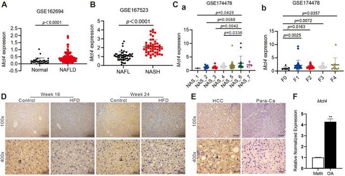 Correlation analysis between the expression of MCT4 in hepatocytes and NAFLD.