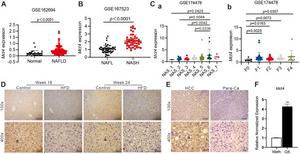 Correlation analysis between the expression of MCT4 in hepatocytes and NAFLD.