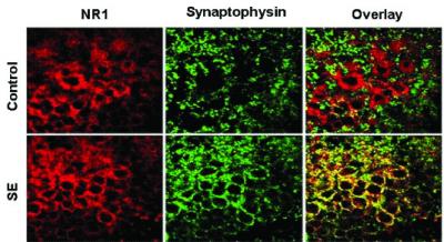 NMDA Receptors