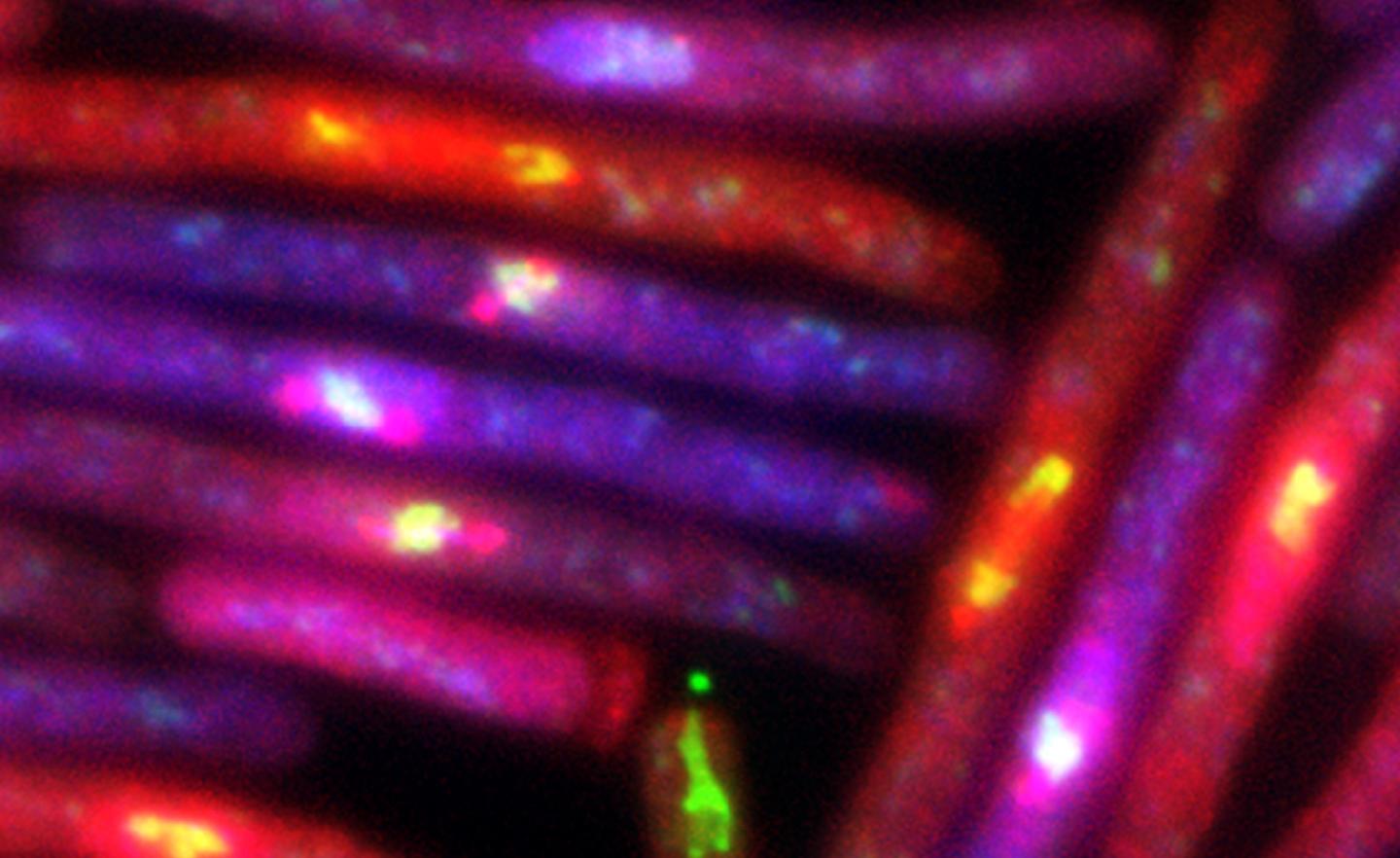 Yeast Anaphase
