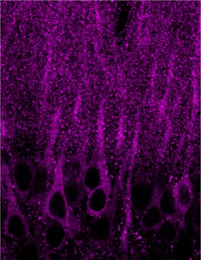 Phosphorylated Receptors
