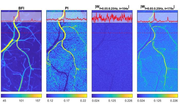 Laser speckle contrast imaging (LSCI) measures blood flow across wide areas of brain tissue with high precision, providing new evidence of how blood vessels coordinate brain perfusion.