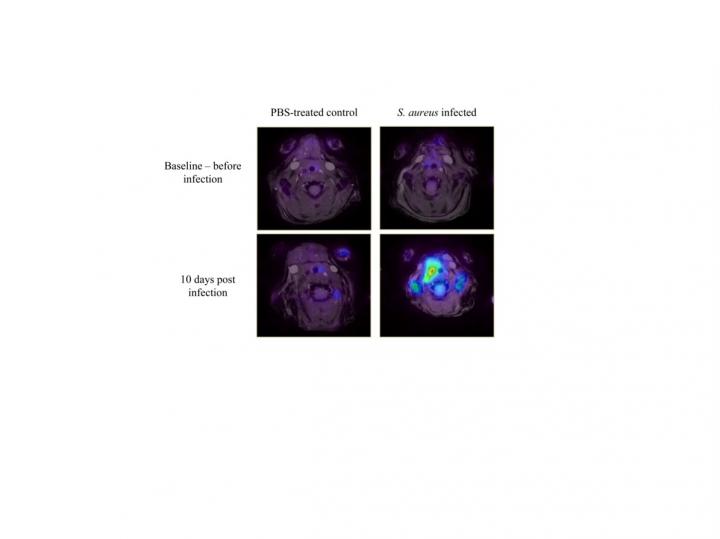 Scientists Pave the Way for Enhanced Detection and Treatment of Vascular Graft Infections