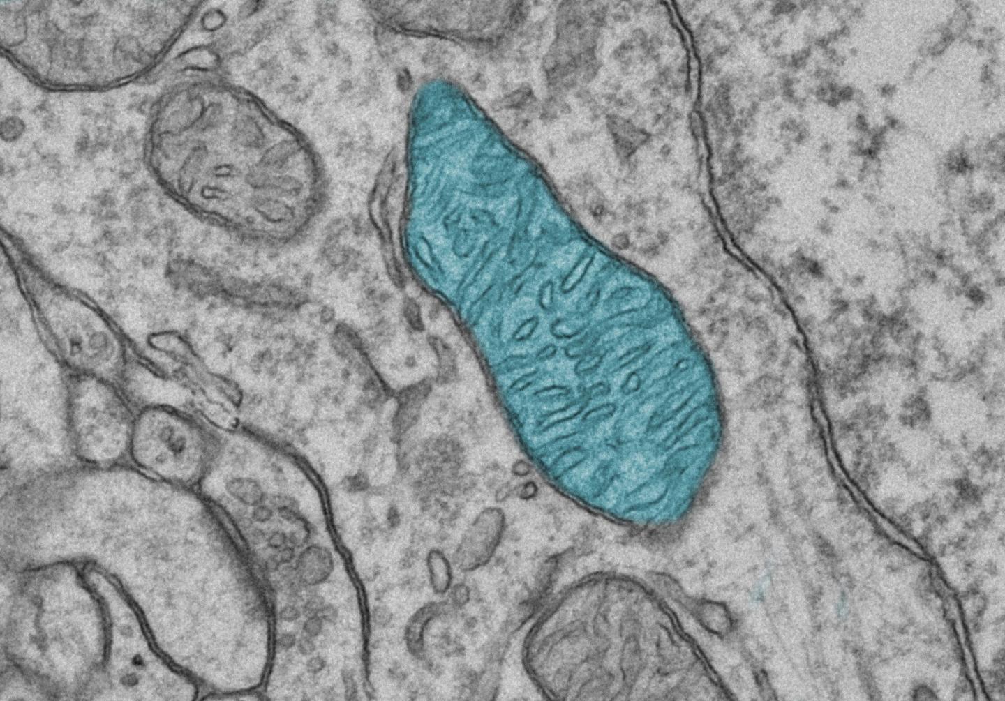 Anxiety Disorders Linked to Disturbances in the Cells' Powerhouses