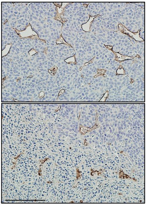 Dual HIF-1/2 inhibitor reduces tumor blood vessel size