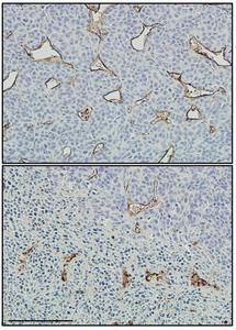 Dual HIF-1/2 inhibitor reduces tumor blood vessel size