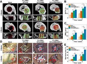 Propelling Biomaterial Innovations for Advanced Cell Therapy