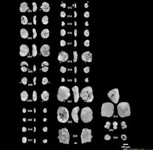 SEM images of foraminifera from the bottle cap