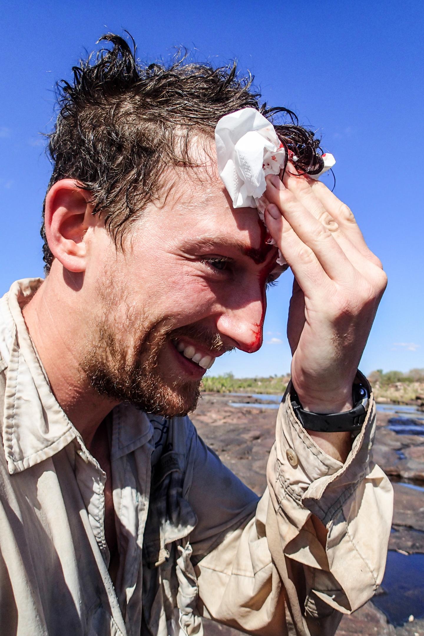 Crocodile Bite