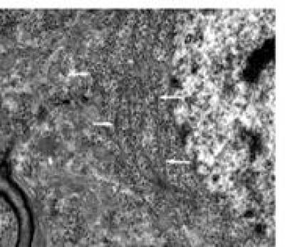 Electron Microscopy