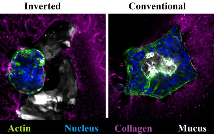 Inverted and conventional cancer cells