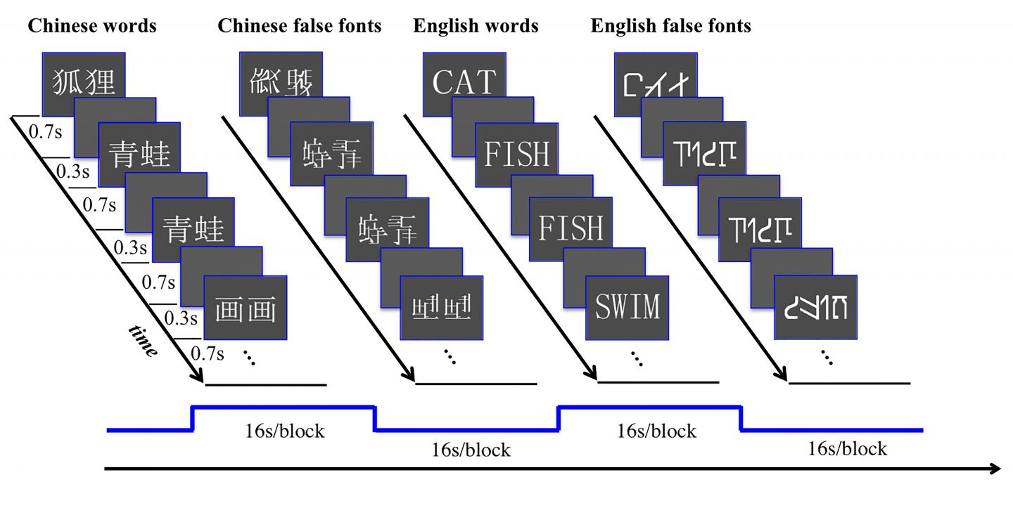 Distinct Language Patterns in the Bilingual Brain (4 of 4)