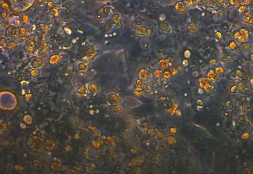 Heart Cells Under Normal Oxygen Conditions
