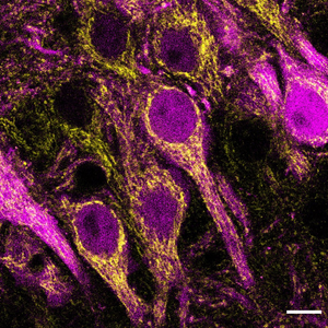 Hippocampus cells