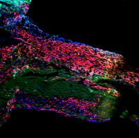 The Heart Wall with the sSar (Red) and Dead Heart Muscle Cells (Pale Green)