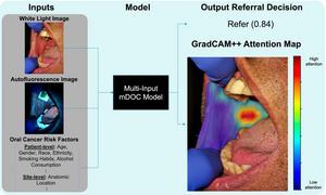 Analysis of an anatomic site using the mobile Detection of Oral Cancer (mDOC) model.