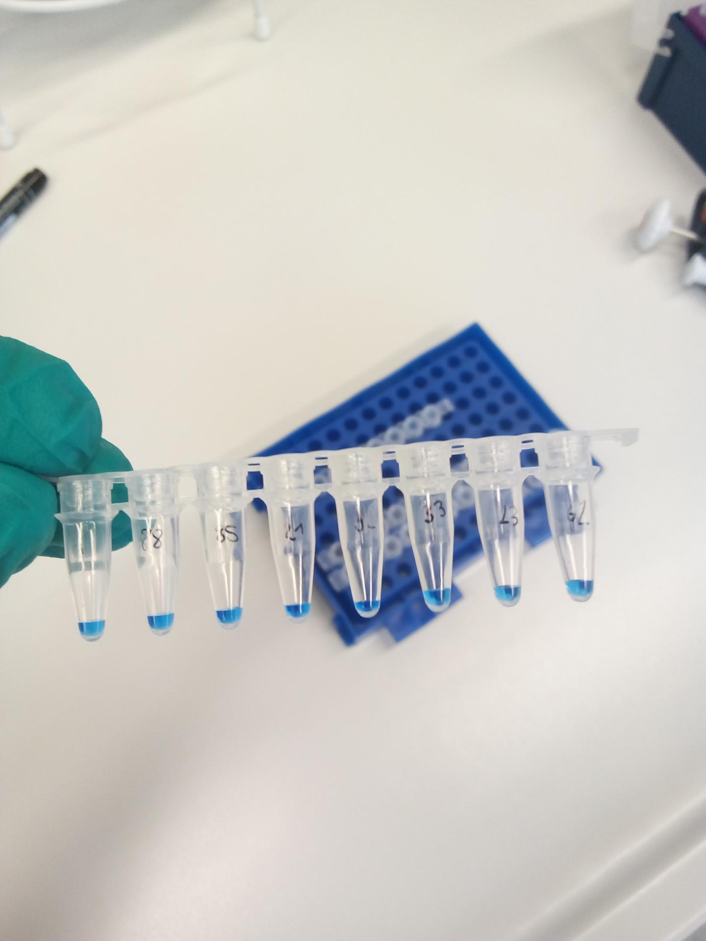 tubes containing clear fluid