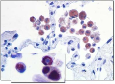 Human Lung Tissue
