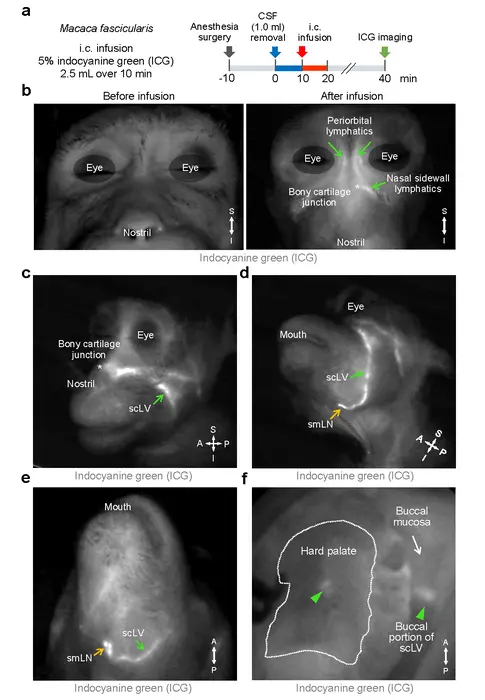 Figure 2. Brain fluid drains through facial and neck lymphatics in monkeys