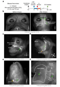 Figure 2. Brain fluid drains through facial and neck lymphatics in monkeys