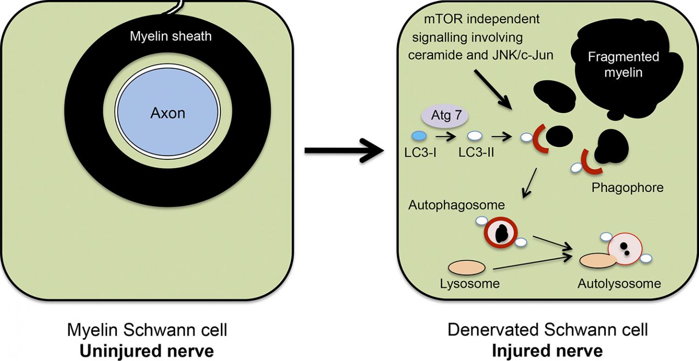 Schwann Cell Myelinophagy