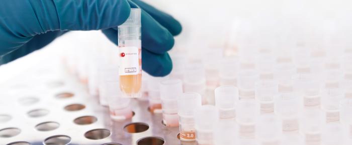 Cryopreseved Cell Banks