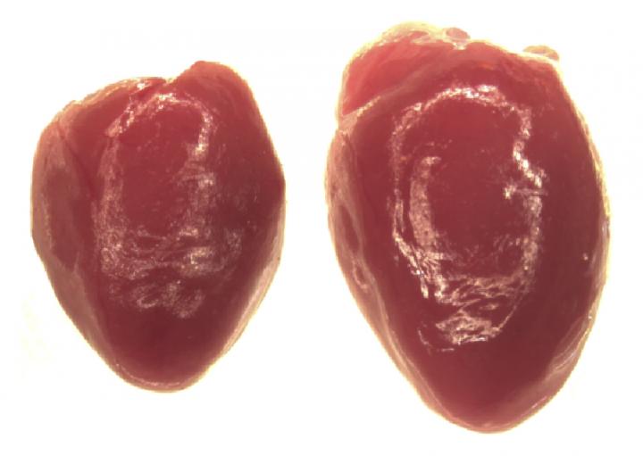 Urocortin 2 Stimulates Abnormal Heart Growth