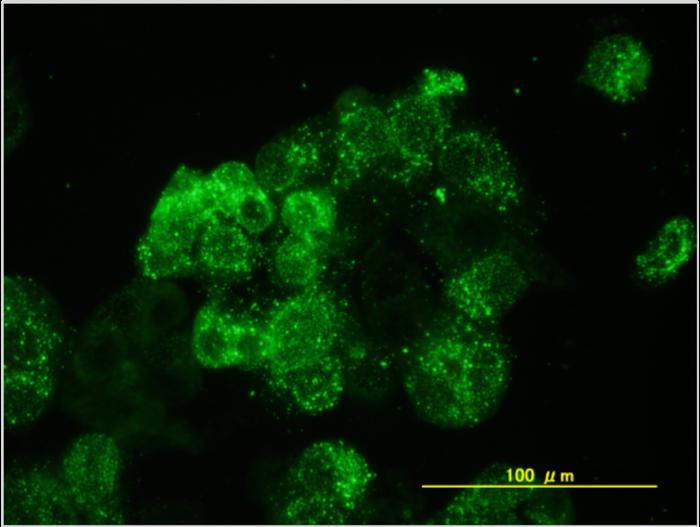Isolation of the Hokkaido virus through detection of viral antigens (green) in kidney cells of the grey red-backed vole (MRK-101 cells).