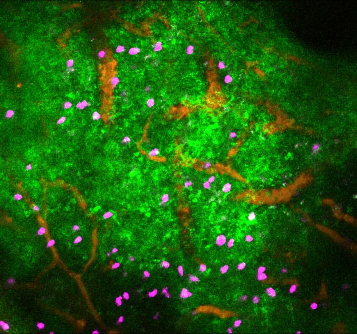 Nervous System Activity in Lymphnode