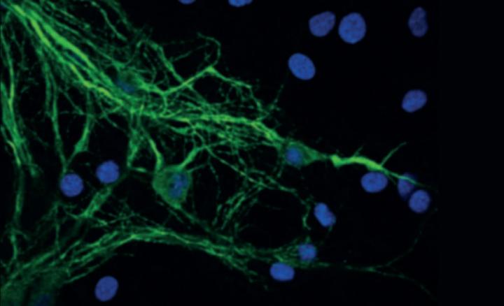 Neurons and Mitochondria