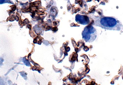 Parasite Host