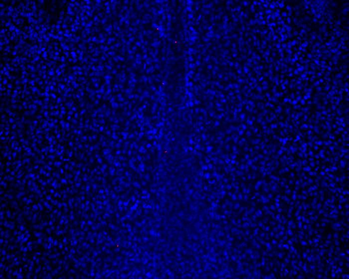 Nanorobots and cells