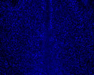 Nanorobots and cells