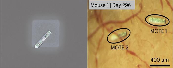 The World's Smallest Fully Wireless Neural Implant Achieved​
